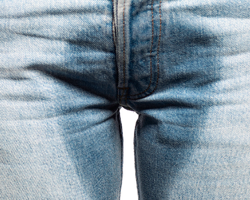 Incontinência Urinária